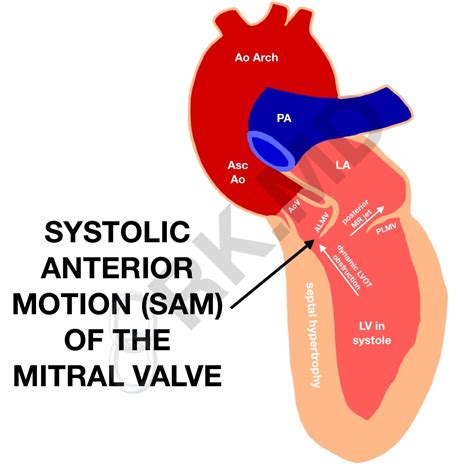 lvot medical abbreviation